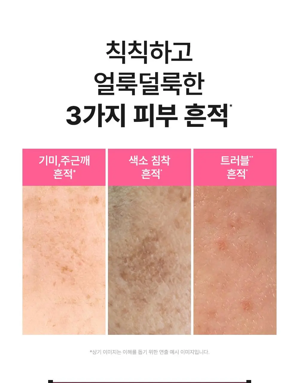 [7일잡티샷/아이돌광채세럼] 비긴스 바이 정샘물 나이아신아마이드10 흔적세럼 리필기획 상세페이지 9